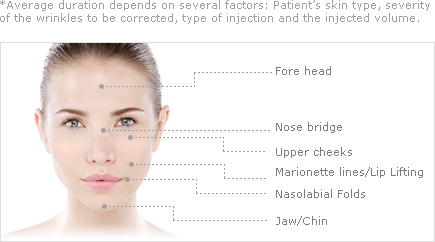 *Average duration depends on several factors Patient's skin type, severity of the wrinkles to be corrected, type of injection and the injected volume.